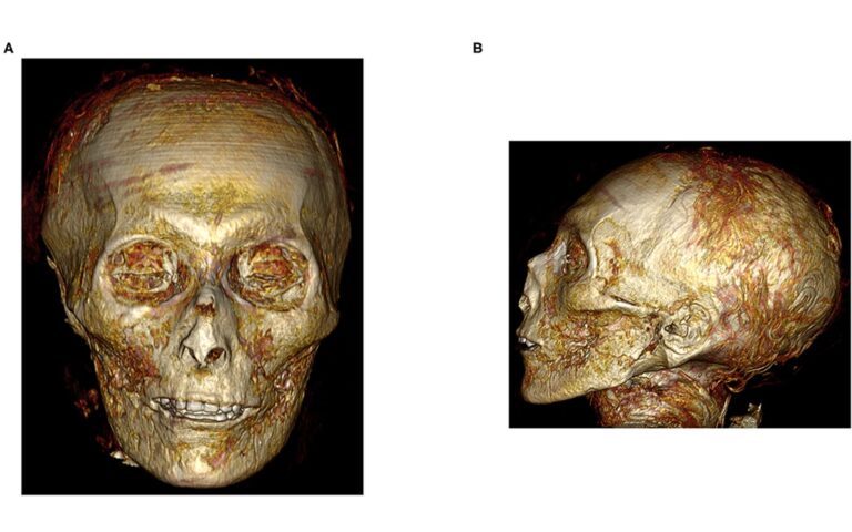 Researchers used CT scans to virtually unwrap a pristine mummy