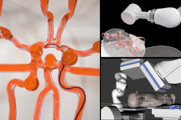 MIT engineers built a robot for emergency stroke surgeries